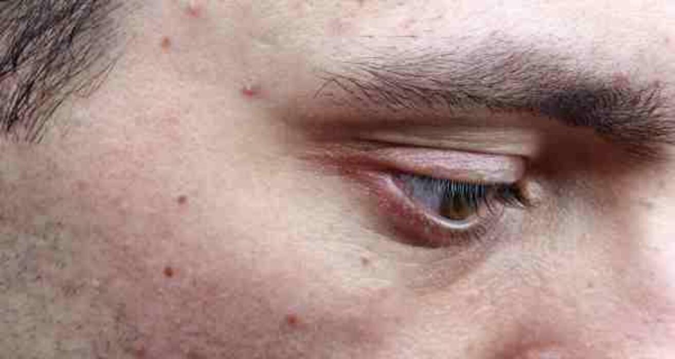 8 signs you are suffering from vitamin and mineral deficiencies
