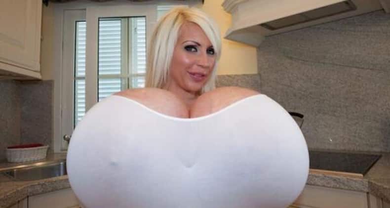 The most bizarre plastic surgeries EVER!