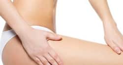 Do away with stretch marks with this easy home remedy