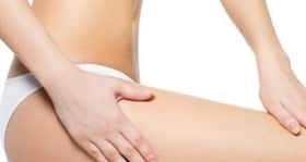Do away with stretch marks with this easy home remedy Do away with stretch marks with this easy home remedy