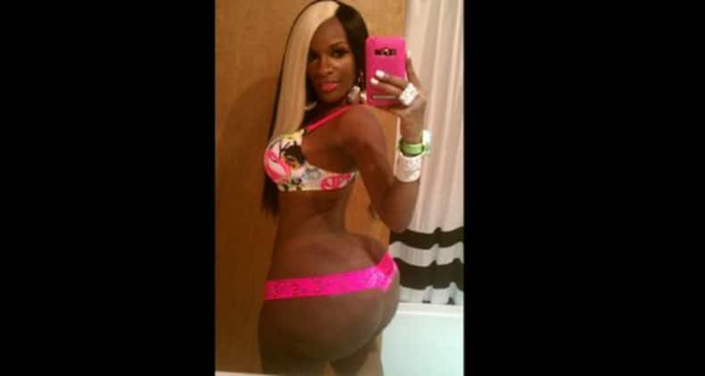 The most bizarre plastic surgeries EVER!