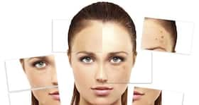 Get rid of blemishes from face and back with these home remedies
