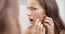 Natural Beauty Tip #7 -- Dab honey to get rid of pimples