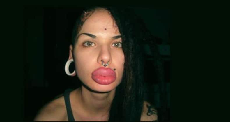The most bizarre plastic surgeries EVER!
