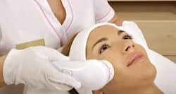 5 expert-recommended laser treatments to get rid of acne scars