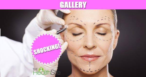Plastic surgeries that are bizarre!
