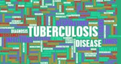 Simple ways to prevent tuberculosis
