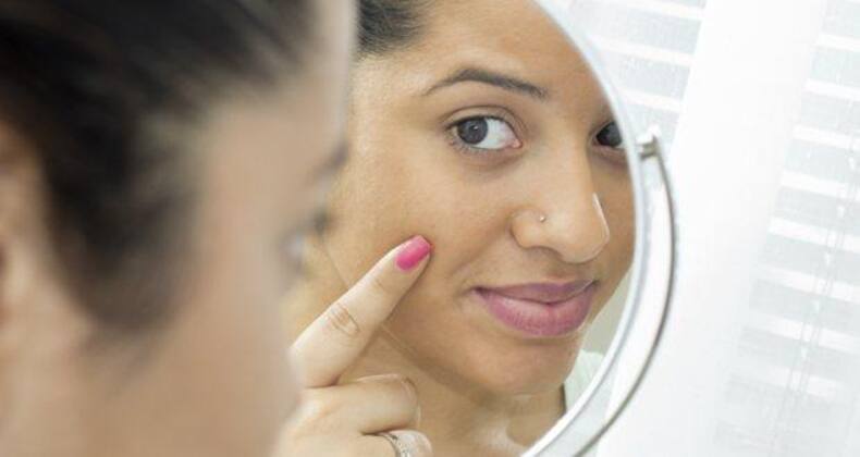 8 easy tips to avoid acne