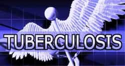 Diagnosing drug-resistant TB could now be faster