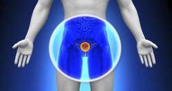 Enlarged prostates can now be treated with 'less pain'