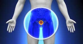 Enlarged prostates can now be treated with 'less pain'