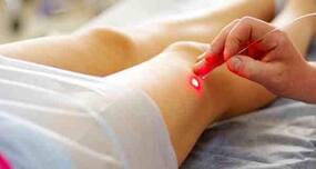 7 home remedies to beat varicose veins