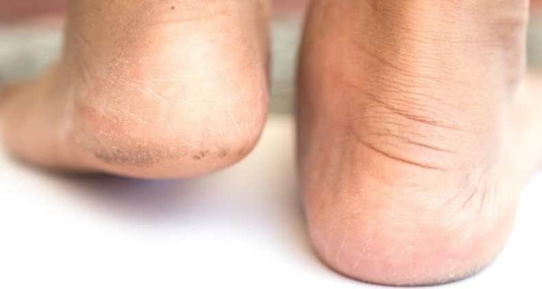 How I hardly spend on pedicures (and you can too!)