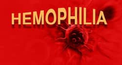 World Haemophilia Day -- real haemophiliacs share how they live with this bleeding disorder