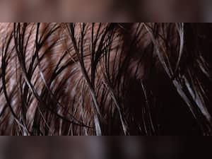 Long Hair Follicular Unit Excision (FUE): All About The Long Hair Transplant