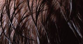Long Hair Follicular Unit Excision (FUE): All About The Long Hair Transplant