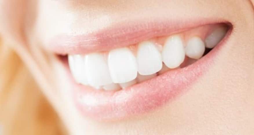 8 natural ways to brighten up your smile | TheHealthSite.com