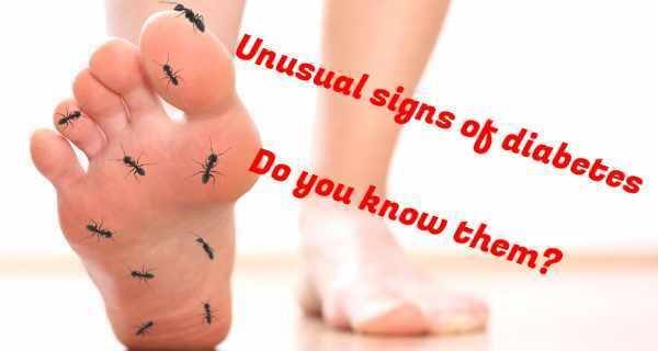 5 unusual signs of diabetes you should watch out for! - Read Health