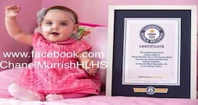 1 minute after her birth, Chanel becomes the youngest patient to undergo an open heart surgery