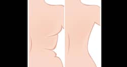 Want a sexy back? Try these exercises!