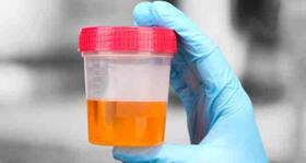 Doctors won't ask for your blood any more, a urine sample will be enough