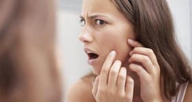 Fight acne with tea tree oil Fight acne with tea tree oil