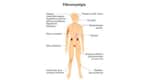 Fibromyalgia