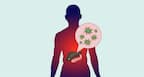 Hepatitis C