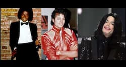 6 cosmetic surgeries that transformed Michael Jackson