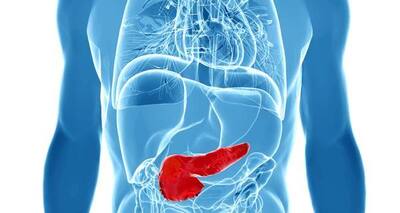 Pancreatic cancer can be detected early with a urine test ...