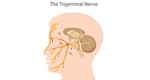 Trigeminal neuralgia