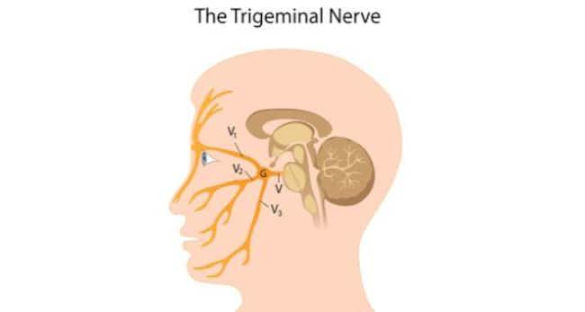 trigeminal-neuralgia