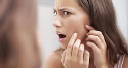 12 Home remedies to remove dark spots naturally