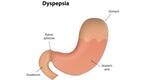 Dyspepsia