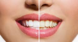 Daily Health Tip: 13 reasons your teeth are turning yellow and you didn't know it! (Slide Show)