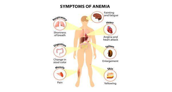 Anemia Symptoms Anemiatreatment Anemia Causes Anemia Diet Anemia In Pregnancy Anemia 5841