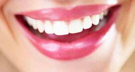 Home remedies for shinier teeth