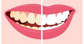 Instantly remove tea/coffee stains from your teeth