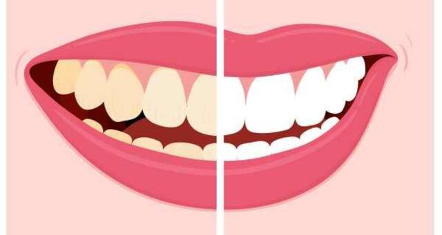 Instantly remove tea/coffee stains from your teeth