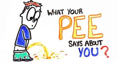 What does your urine colour say about you?