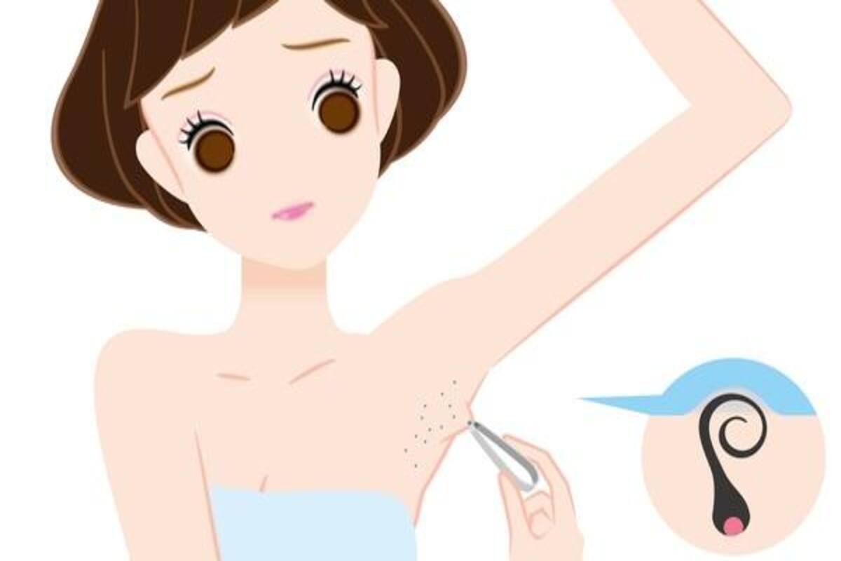 Have You Tried The Sweet Home Remedy For Ingrown Hair