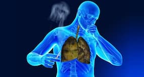 Causes of chest congestion and remedies