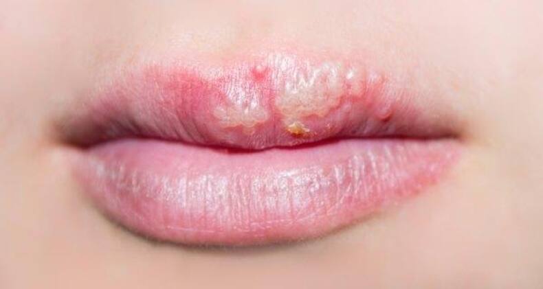7 ways your mouth is warning you about your health!