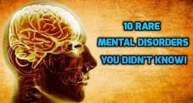 10 rare mental disorders that are totally legit (and spooky)!