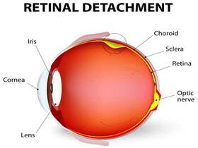 Blurred vision may indicate retinal disease, says study