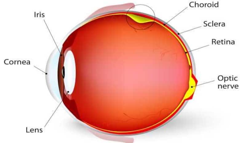 retinal-detachment