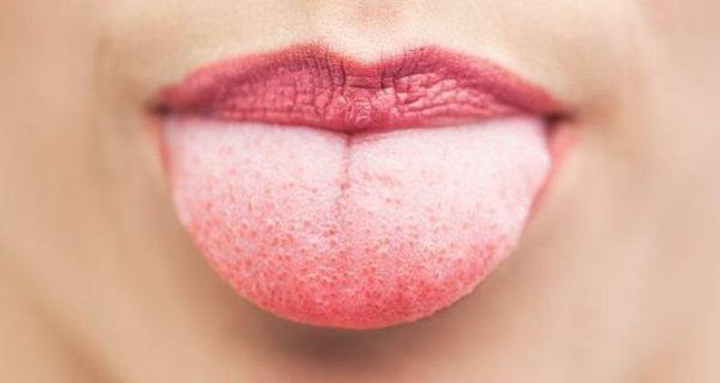 7 ways your mouth is warning you about your health!