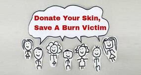 Here's everything you need to know about skin donation