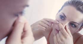 You have to try this no-fail remedy for blackheads