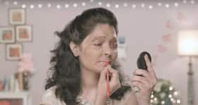 This acid attack survivor's make-up tutorial is the BEST thing you'll watch today
